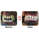 トーラス プラケアシート 30枚