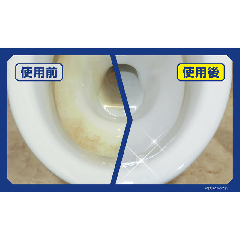 アイオン （新津春子）トイレの黄ばみ尿石洗浄剤ジェルタイプ