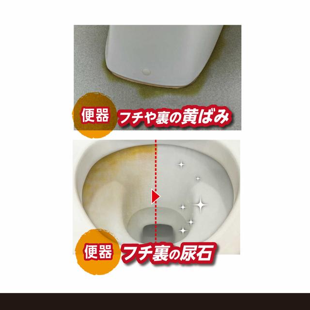 Kazuya Motegi Urinary Stone Remover Gel 100g