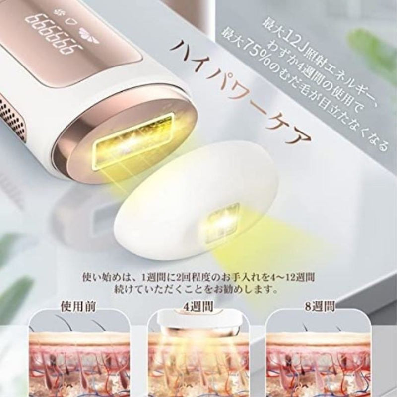 家庭用脱毛器セット Pro 05-ADTMP-002 メーカー直送 ▼返品・キャンセル不可【他商品との同時購入不可】