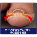 サイプラス 巻き爪テープクイこまなーい 10枚入り