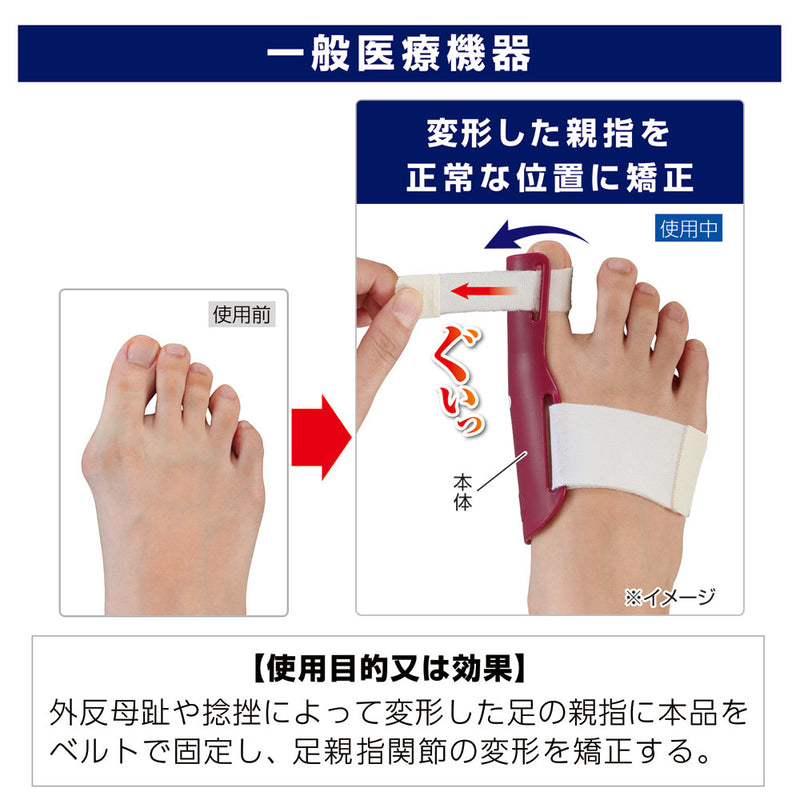 【一般医療機器】サイプラス プラスウォーク 外反母趾矯正プロテクター 右足用 1個