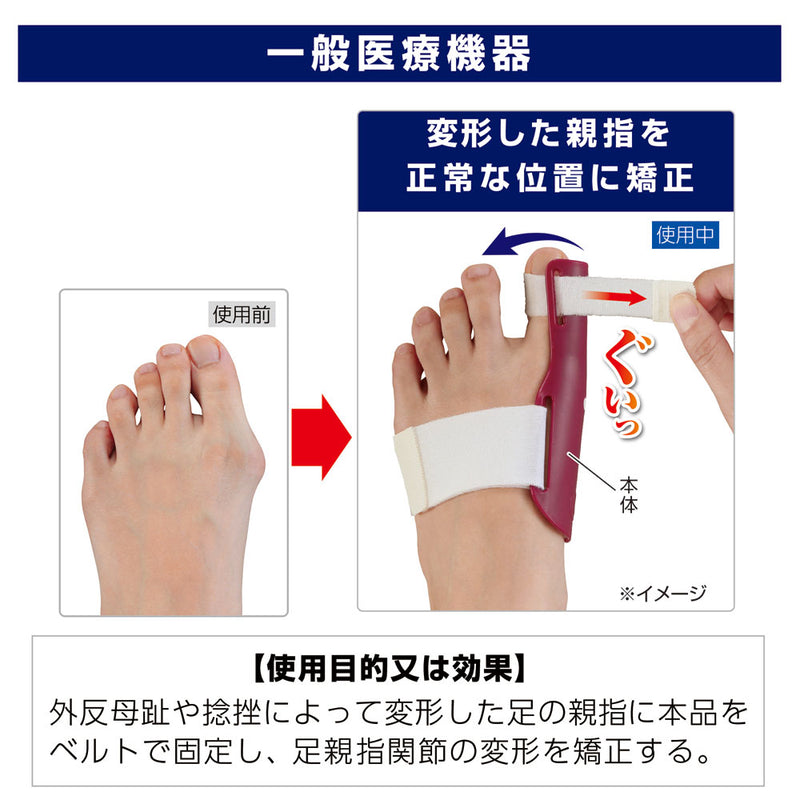 【一般医療機器】サイプラス プラスウォーク 外反母趾矯正プロテクター 左足用 1個