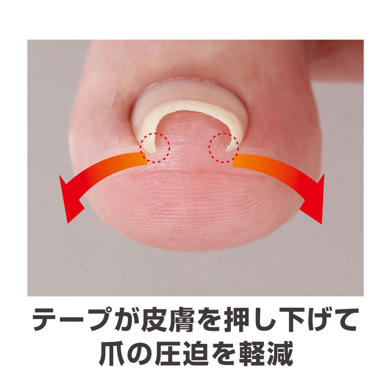 サイプラス 透明巻き爪テープ ミエーヌ 10枚