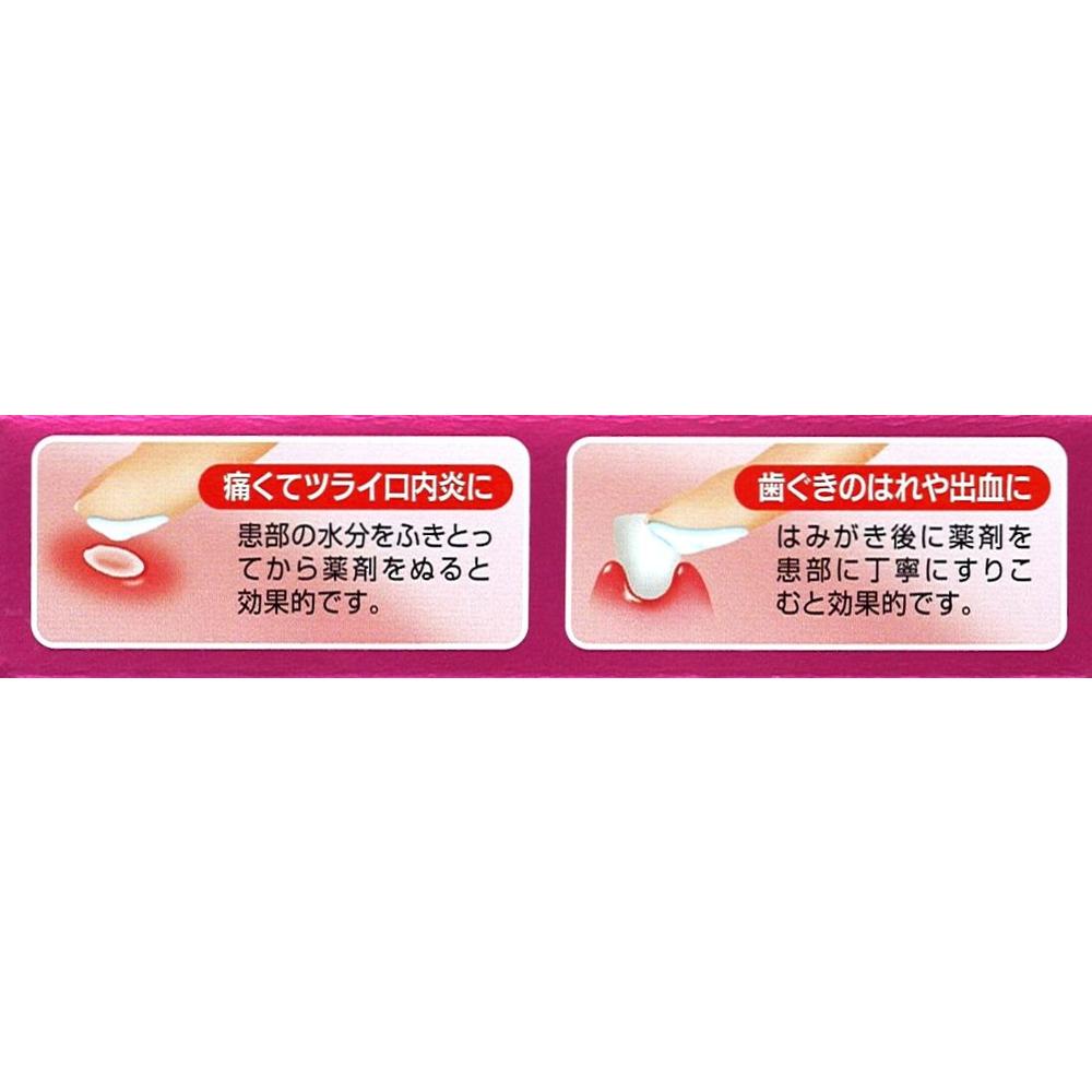 第3類医薬品】新デスパコーワ 7G