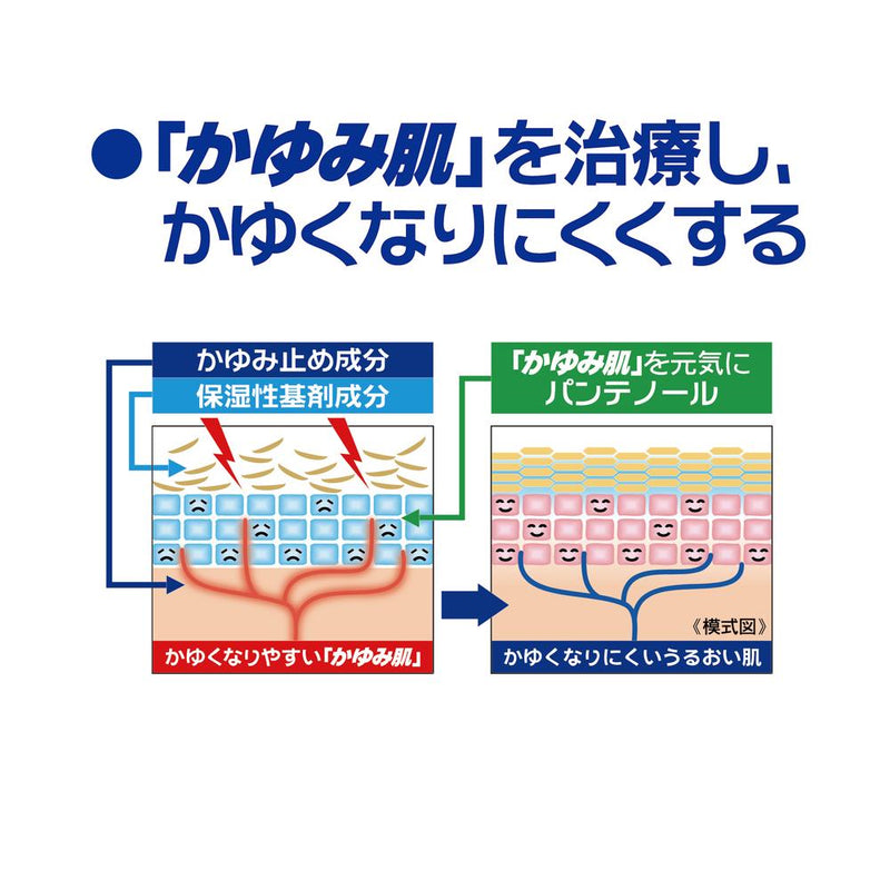 【第3類医薬品】かゆみ肌の治療薬 ムヒソフトGX乳状液 120ml ★