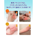 【指定第2類医薬品】池田模範堂 液体アセムヒEX ３５ｍｌ【セルフメディケーション税制対象】