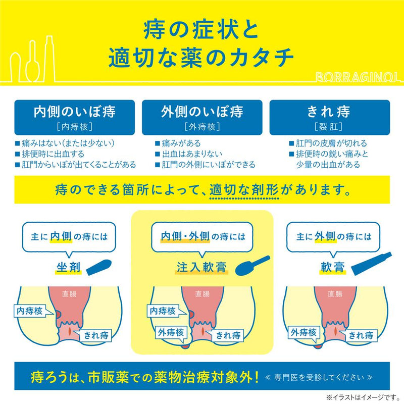 【指定第2類医薬品】ボラギノールA注入軟膏2g×10個